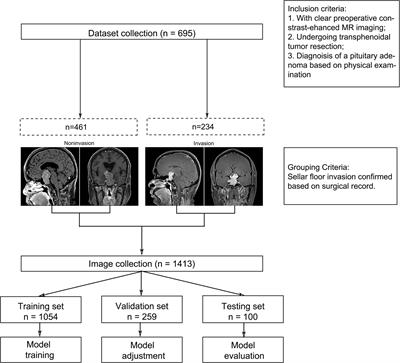 A Convolutional Neural Network Model for Detecting Sellar Floor Destruction of Pituitary Adenoma on Magnetic Resonance Imaging Scans